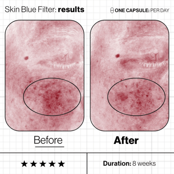 Skin Blue Filter - Image 3