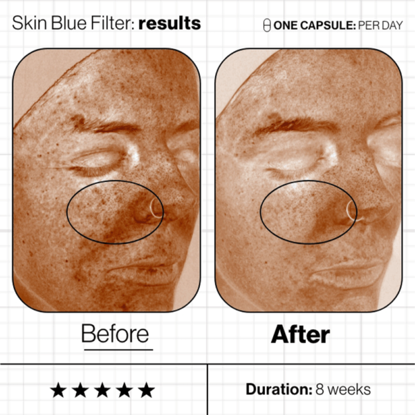 Skin Blue Filter - Image 4