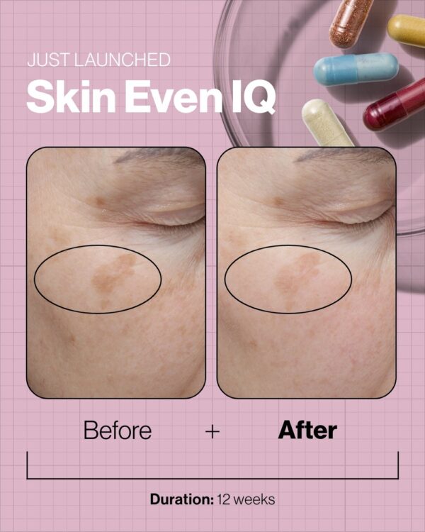 Skin Even IQ - Image 3