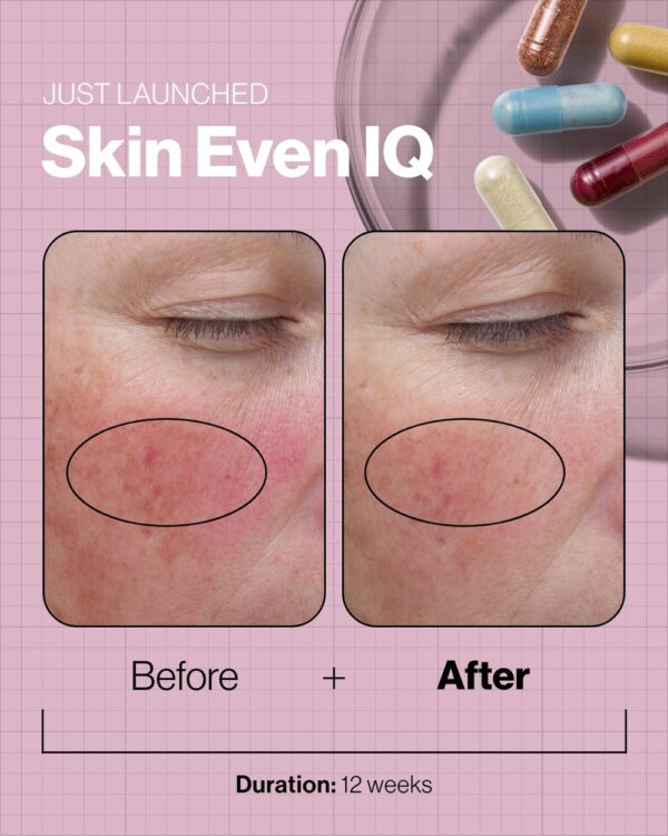 Skin Even IQ - Image 4