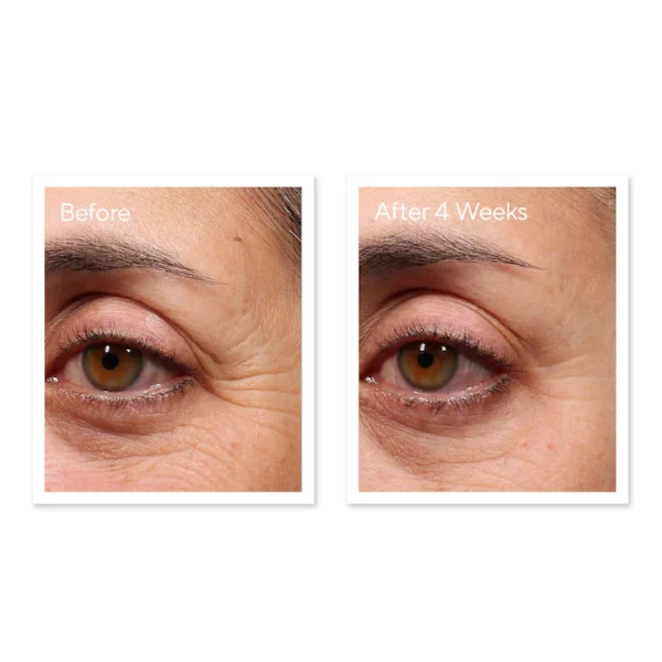 Retinol Youth Renewal Eye Serum - Image 3