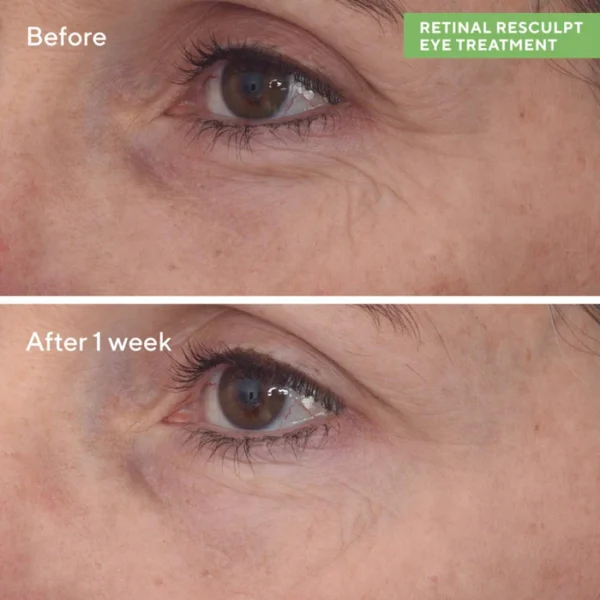 Retinal Resculpt Advanced Eye Lift Treatment for Aging Skin - Image 2