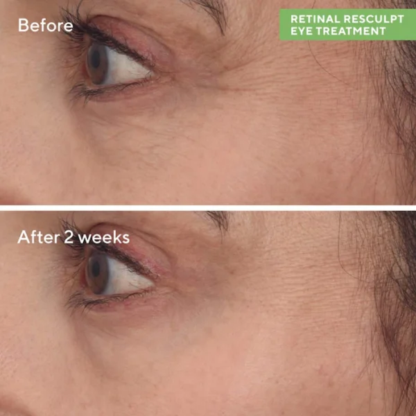 Retinal Resculpt Advanced Eye Lift Treatment for Aging Skin - Image 3