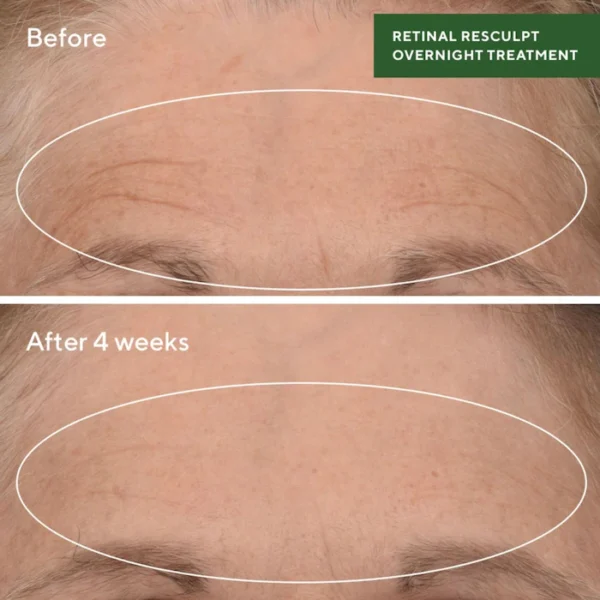 Retinal ReSculpt Overnight Treatment - Image 3