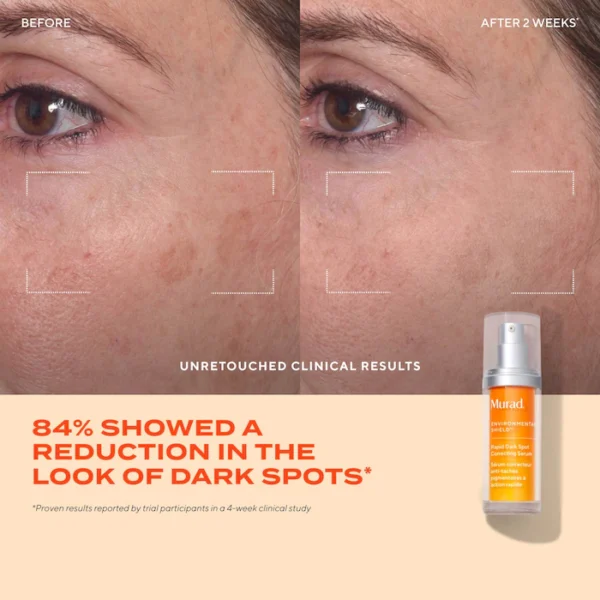 Rapid Dark Spot Correcting Serum - Image 4