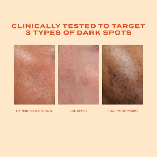 Rapid Dark Spot Correcting Serum - Image 5
