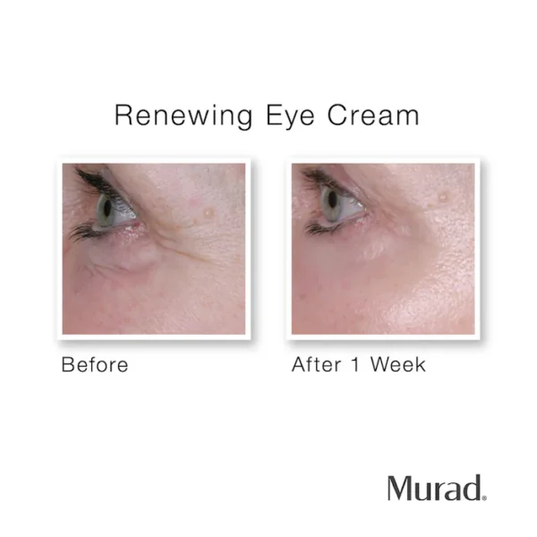 Renewing Eye Cream - Image 3