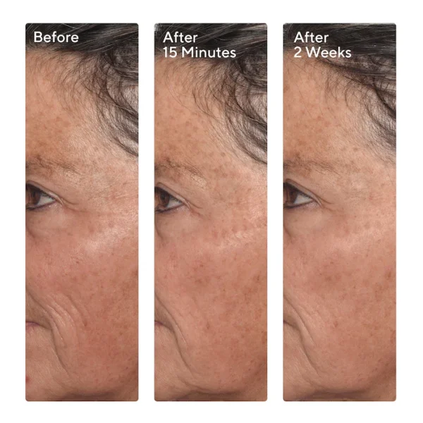 Targeted Wrinkle Corrector - Image 5