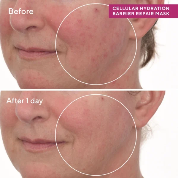 Cellular Hydration Barrier Repair Mask - Image 3